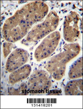 TMEM181 Antibody