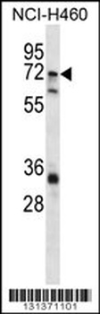 ST6GALNAC1 Antibody