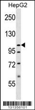 SLC12A7 Antibody