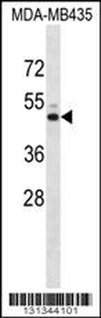 KCNJ13 Antibody