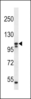 SLC12A6 Antibody