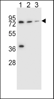 UGT2B15 Antibody