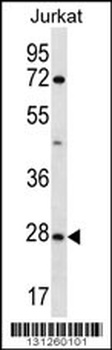 OR6T1 Antibody