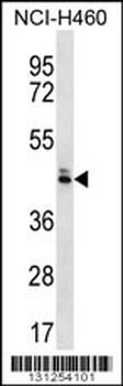 OR52N5 Antibody