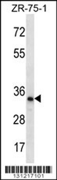 TLCD2 Antibody