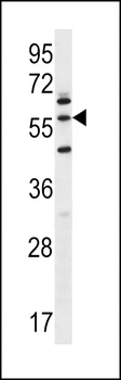 LETM2 Antibody