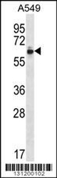 ZNF417 Antibody