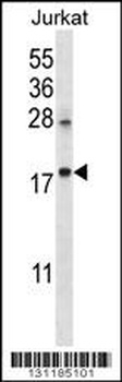 KRTAP25-1 Antibody