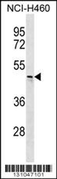 CHST6 Antibody