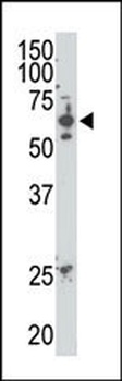 SENP2 Antibody