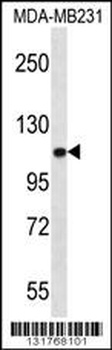 ACTN3 Antibody