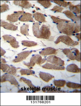 ACTN3 Antibody