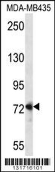 DVL1 Antibody