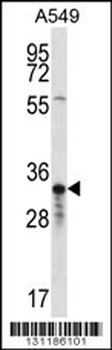 OR4F5 Antibody