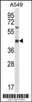 OR51S1 Antibody