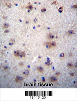 EVPLL Antibody