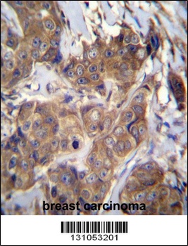ATP6V1B1 Antibody
