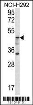 GBA3 Antibody