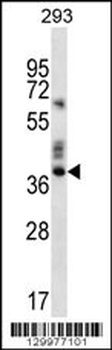 OR9K2 Antibody