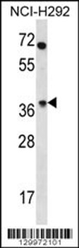 OR4N2 Antibody