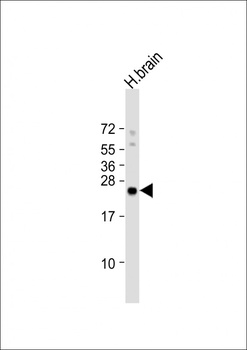 RHOB Antibody