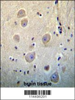 RHOB Antibody