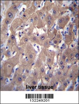 AKR1C2 Antibody