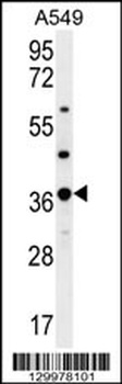 OR4M1 Antibody