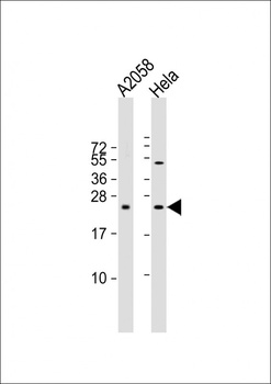 SDHD Antibody