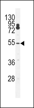 CPSF7 Antibody