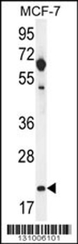 hCG_1646420 Antibody
