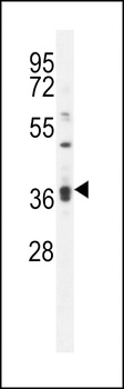 KLHL35 Antibody