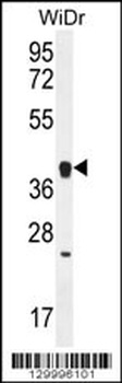 OR2T8 Antibody