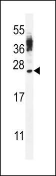 CT45A4 Antibody
