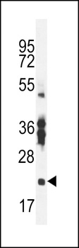 RBPMS2 Antibody