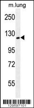 SPECC1L Antibody