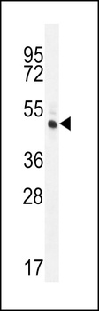 RINL Antibody