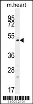 TSPYL4 Antibody