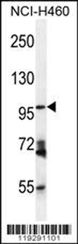 ENPEP Antibody