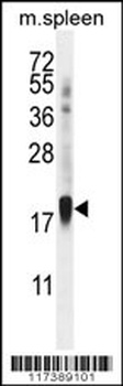 ZNF593 Antibody