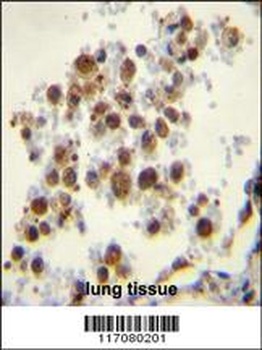 TBXAS1 Antibody