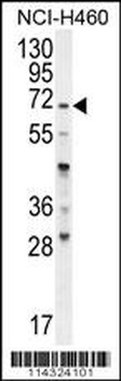 FUT4 Antibody