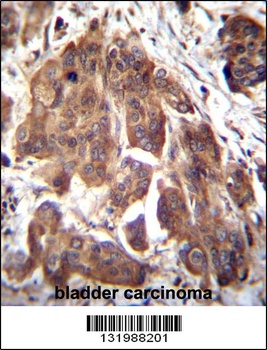 GLMN Antibody