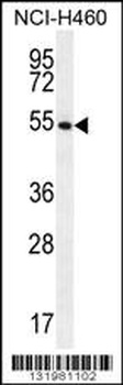 GSR Antibody