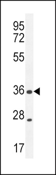 XCR1 Antibody