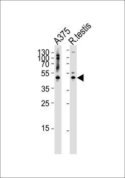 AP1M1 Antibody