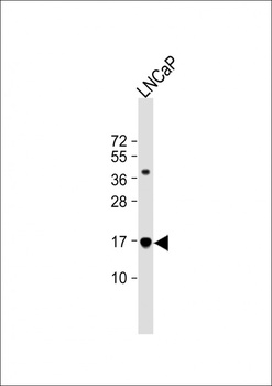 TBCA Antibody