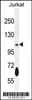 PDE3B Antibody