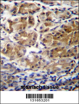 PDPR Antibody