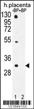 OR1D5 Antibody